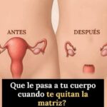 ¿Qué pasa realmente cuando te quitan la matriz? Entiende los cambios en tu cuerpo