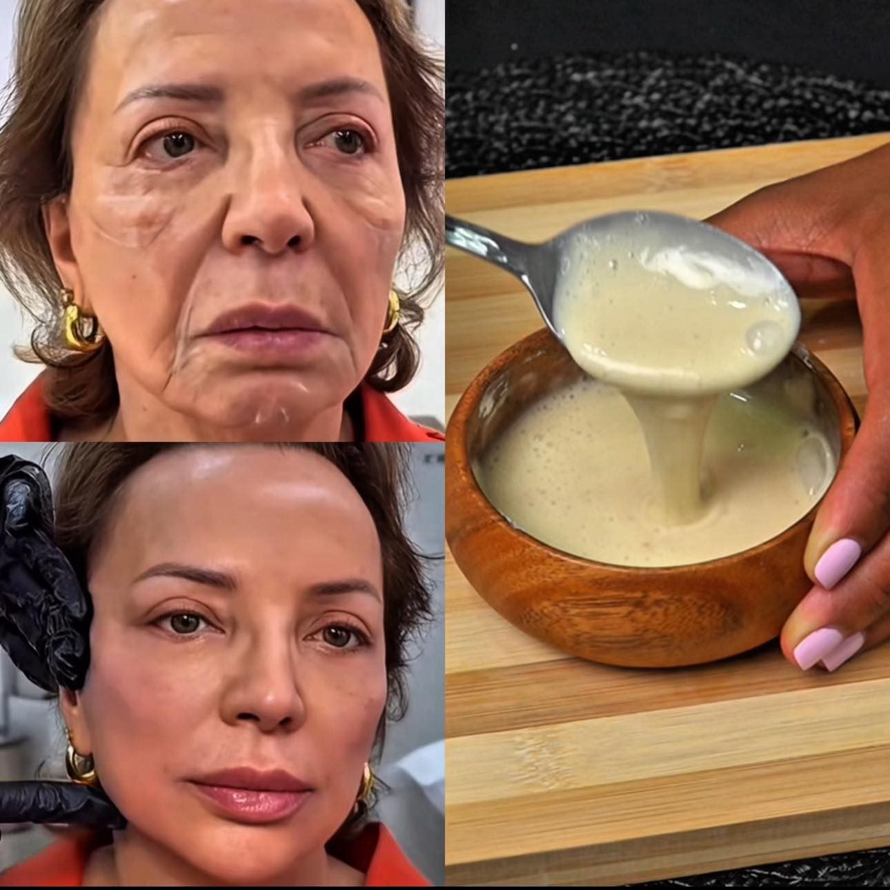 Antes y después de tratamiento facial