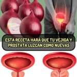 Recetas Naturales para Mejorar la Salud de la Vejiga y Próstata: Descubre los Beneficios de la Cebolla