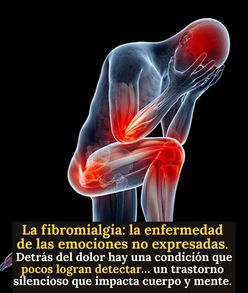 Ilustración de la fibromialgia