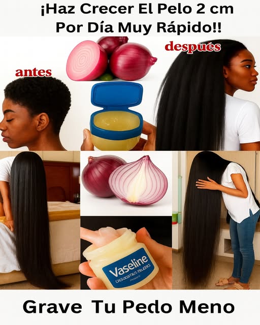 Vaselina y cebolla como remedios para el crecimiento del cabello